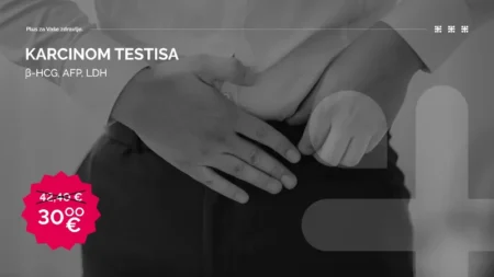 Paket Karcinom testisa