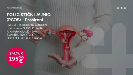 Paket Policistični jajnici (PCOS)- prošireni