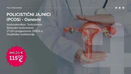 Paket Policistični jajnici (PCOS)- osnovni